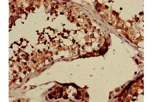 Immunohistochemistry of paraffin-embedded human testis tissue using ABIN7147850 at dilution of 1:100 (CLTCL1 anticorps  (AA 1423-1566))