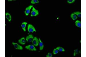 Immunofluorescence staining of A549 cells with ABIN7147182 at 1:100, counter-stained with DAPI.