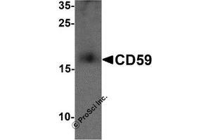 Western Blotting (WB) image for anti-CD59 (CD59) (N-Term) antibody (ABIN1077443) (CD59 anticorps  (N-Term))