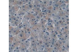 Used in DAB staining on fromalin fixed paraffin- embedded Kidney tissue