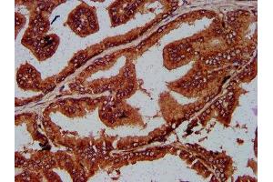 anti-Sad1 and UNC84 Domain Containing 2 (SUN2) (AA 45-155) antibody