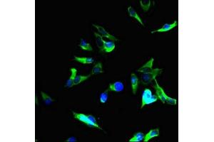 anti-Tuberous Sclerosis 2 (TSC2) (AA 1396-1496) antibody