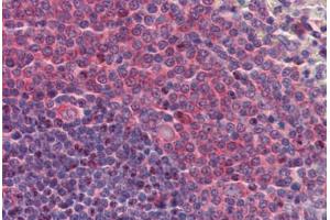 Human Spleen: Formalin-Fixed, Paraffin-Embedded (FFPE)