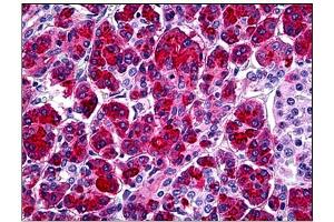 Immunohistochemistry (IHC) image for anti-serine Peptidase Inhibitor, Kazal Type 1 (SPINK1) antibody (ABIN781831)