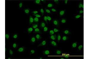 Immunofluorescence of monoclonal antibody to GATA2 on HeLa cell.