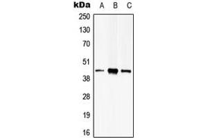 Western blot analysis of PSKH2 expression in Hela (A), HEK293T (B), mouse brain (C) whole cell lysates. (PSKH2 anticorps  (Center))