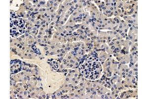 ABIN7096450 and ABIN7100514 at 1/100 staining mouse kidney tissue by IHC-P. (CHMP4C anticorps)