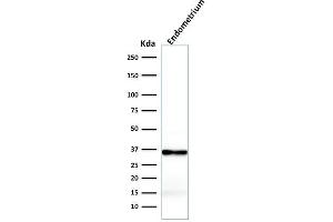 anti-Calponin 1 (CNN1) antibody