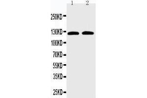 Anti-SLC12A6 antibody, Western blotting Lane 1: HELA Cell Lysate Lane 2: HUT102 Cell Lysate
