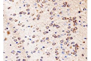 IHC analysis of Kinectin 1/KTN1 using anti-Kinectin 1/KTN1 antibody (ABIN7601096). (KTN1 anticorps  (AA 283-827))