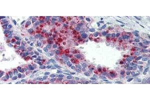 Immunohistochemistry with Human Prostate lysate tissue at an antibody concentration of 5. (KCNK9 anticorps  (N-Term))