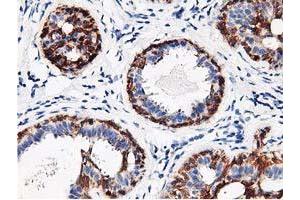 Immunohistochemical staining of paraffin-embedded Human breast tissue using anti-RBBP7 mouse monoclonal antibody. (RBBP7 anticorps)