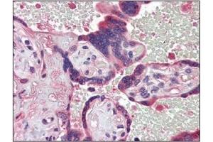 Immunohistochemistry (IHC) image for anti-Tyrosyl-DNA Phosphodiesterase 1 (TDP1) (AA 1-298), (N-Term) antibody (ABIN400858) (TDP1 anticorps  (N-Term))
