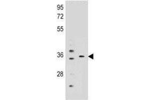KCNRG antibody western blot analysis in mouse liver, lung tissue lysate (KCNRG anticorps  (AA 175-202))