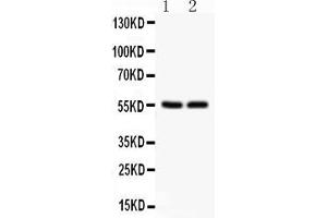 Anti- SLC2A1  Picoband antibody, Western blottingAll lanes: Anti SLC2A1  at 0.