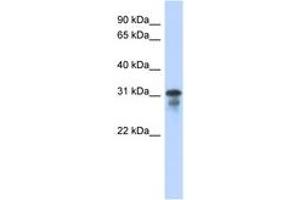 Image no. 1 for anti-Mediator Complex Subunit 6 (MED6) (C-Term) antibody (ABIN6742443) (MED6 anticorps  (C-Term))