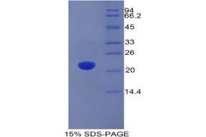 SDS-PAGE analysis of Rat ADM Protein. (Adrenomedullin Protein (ADM))