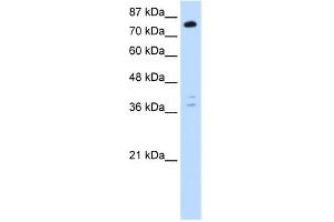 WB Suggested Anti-TSC22D2 Antibody Titration:  0. (TSC22D2 anticorps  (C-Term))