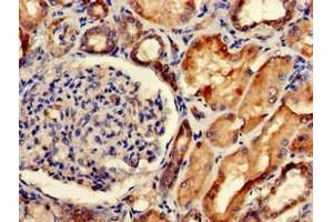 Immunohistochemistry of paraffin-embedded human kidney tissue using ABIN7175662 at dilution of 1:100 (SORCS2 anticorps  (AA 712-786))