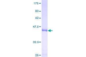 Image no. 1 for Vacuolar Protein-Sorting-Associated Protein 25 (VPS25) (AA 1-176) protein (GST tag) (ABIN1325054)