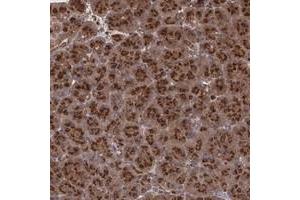 Immunohistochemical staining of human pancreas with TRIP11 polyclonal antibody  shows strong cytoplasmic positivity with a granular pattern in exocrine glandular cells. (Thyroid Hormone Receptor Interactor 11 (TRIP11) anticorps)
