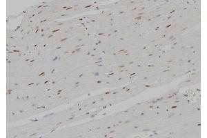 ABIN6267588 at 1/100 staining Rat heart tissue by IHC-P.