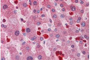 anti-Glutamate-Cysteine Ligase, Modifier Subunit (GCLM) (AA 182-231) antibody