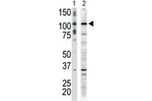 Western Blotting (WB) image for anti-Mitogen-Activated Protein Kinase Kinase Kinase 9 (MAP3K9) antibody (ABIN3003574) (MAP3K9 anticorps)
