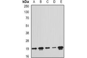 Western blot analysis of PTRH2 expression in MCF7 (A), A549 (B), mouse liver (C), mouse spleen (D), rat brain (E) whole cell lysates. (PTRH2 anticorps)