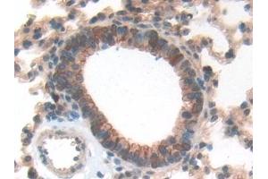 Detection of GFAP in Mouse Lung Tissue using Polyclonal Antibody to Glial Fibrillary Acidic Protein (GFAP)