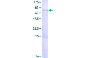 Image no. 1 for CCAAT/enhancer Binding Protein (C/EBP), beta (CEBPB) (AA 1-345) protein (GST tag) (ABIN7540239)