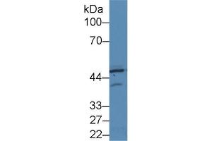 Western blot analysis of Human HeLa cell lysate, using Rat PKR Antibody (2 µg/ml) and HRP-conjugated Goat Anti-Rabbit antibody ( (EIF2AK2 anticorps  (AA 279-506))