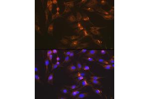 Immunofluorescence analysis of C6 cells using GLUT2/SLC2 Rabbit mAb (ABIN7270414) at dilution of 1:100 (40x lens).