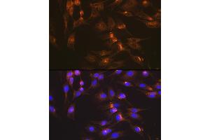 Immunofluorescence analysis of C6 cells using GLUT2/SLC2 Rabbit mAb (ABIN7270414) at dilution of 1:100 (40x lens). (SLC2A2 anticorps)