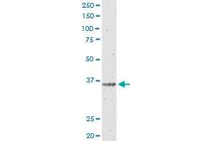 IL12B monoclonal antibody (M01), clone 2H6.