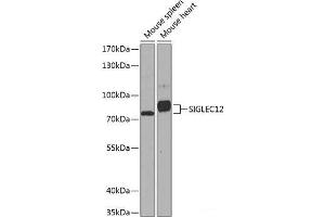 Western blot analysis of extracts of various cell lines using SIGLEC12 Polyclonal Antibody at dilution of 1:1000. (SIGLEC12 anticorps)
