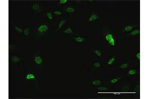 Immunofluorescence of purified MaxPab antibody to CRKL on HeLa cell.