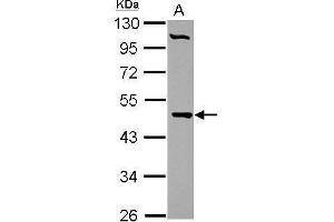 WB Image Sample (30 ug of whole cell lysate) A: HepG2 10% SDS PAGE antibody diluted at 1:1000 (PCYT2 anticorps)