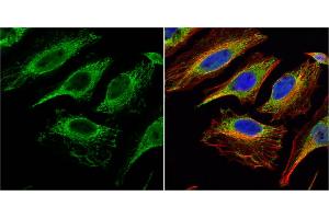 ICC/IF Image Citrate synthetase antibody [N2C3] detects Citrate synthetase protein at mitochondria by immunofluorescent analysis. (CS anticorps)