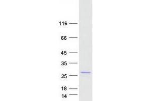 Validation with Western Blot
