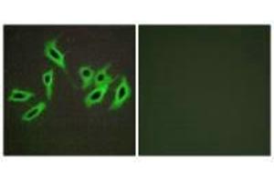 Immunofluorescence analysis of HepG2 cells, using Heparin Cofactor II antibody. (SERPIND1 anticorps)