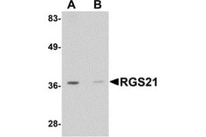 Western Blotting (WB) image for anti-Regulator of G-Protein Signaling 21 (RGS21) (Middle Region) antibody (ABIN1031060) (RGS21 anticorps  (Middle Region))
