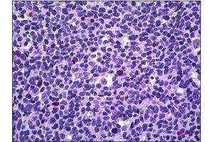 Human Tonsil, Lymphocytes: Formalin-Fixed, Paraffin-Embedded (FFPE) (PPP3CA anticorps  (N-Term))