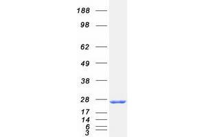 Validation with Western Blot