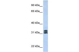 PYCR2 antibody used at 1 ug/ml to detect target protein. (PYCR2 anticorps  (Middle Region))