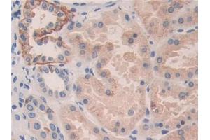 DAB staining on IHC-P; Samples: Human Kidney Tissue
