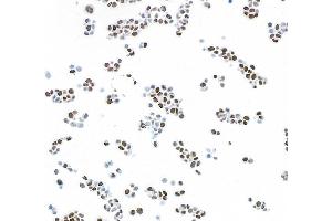 Immunocytochemistry (ICC) image for anti-Poly (ADP-Ribose) Polymerase 1 (PARP1) (AA 750-800) antibody (ABIN7449531) (Recombinant PARP1 anticorps  (AA 750-800))