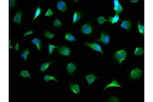 Immunofluorescence staining of A549 cells with ABIN7154202 at 1:100, counter-stained with DAPI. (AGL anticorps  (AA 1217-1378))