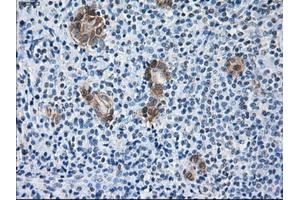 Immunohistochemical staining of paraffin-embedded Kidney tissue using anti-SORDmouse monoclonal antibody. (SORD anticorps)