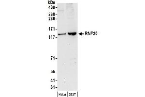 Western Blotting (WB) image for anti-Ring Finger Protein 20 (RNF20) (AA 125-175) antibody (ABIN7454669)